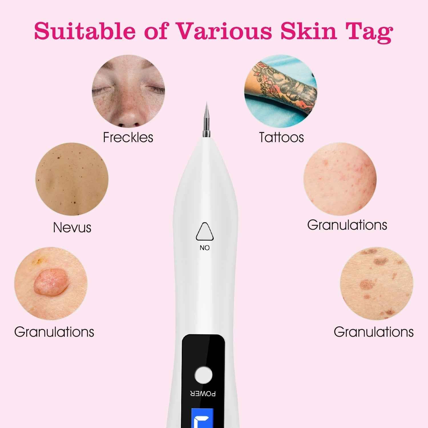 1Pc Skin Tag Repair Kit Portable Beauty Equipment Multi-Level With Home Usage USB Charging LCD Level Adjustable 6 Replaceable Needles