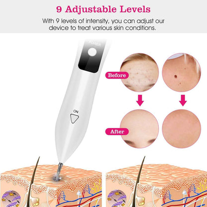 1Pc Skin Tag Repair Kit Portable Beauty Equipment Multi-Level With Home Usage USB Charging LCD Level Adjustable 6 Replaceable Needles